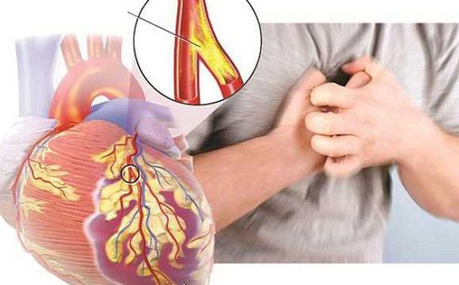 Bệnh tim mạch và mối đe dọa từ Covid-19 