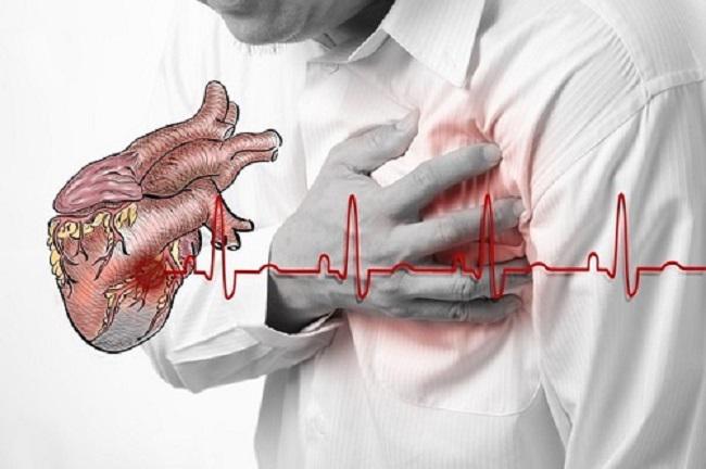 Bệnh suy tim sung huyết và những điều bạn cần biết
