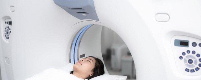 Khi nào nên chụp cộng hưởng từ não MRI?