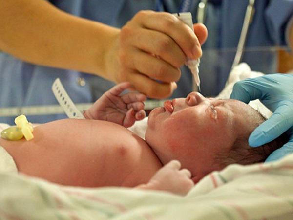 Bệnh võng mạc ở trẻ sinh non diễn biến như thế nào?