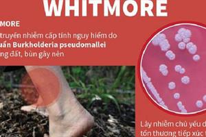 Phòng tránh bệnh Whitmore theo khuyến cáo của Bộ y tế