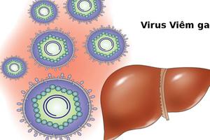Viêm gan virus B là gì? Phòng tránh viêm gan B
