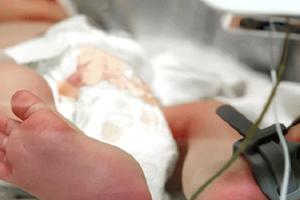 Biến chứng và di chứng của viêm màng não mủ ở trẻ sơ sinh