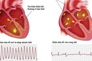 7 bệnh tim mạch thường gặp và các triệu chứng