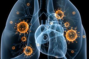 Phòng chữa bệnh viêm phổi hiệu quả