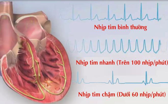 4 dấu hiệu cho thấy tim mạch đang gặp vấn đề