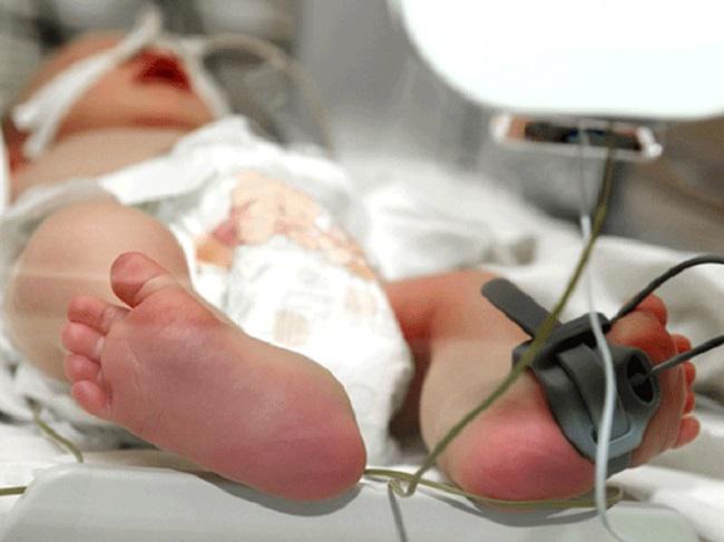 Biến chứng và di chứng của viêm màng não mủ ở trẻ sơ sinh