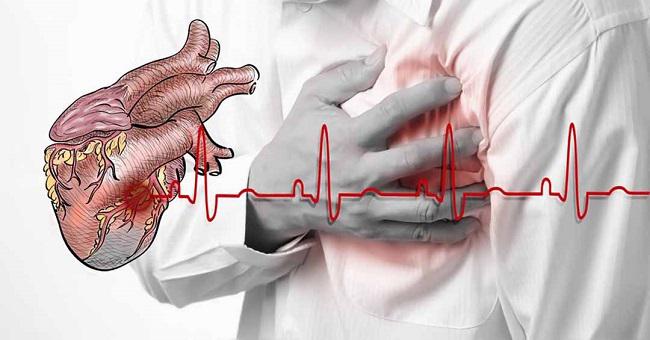 Tại sao cao huyết áp lại gây suy tim?