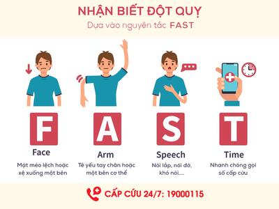 Nhận biết đột quỵ dựa vào nguyên tắc FAST