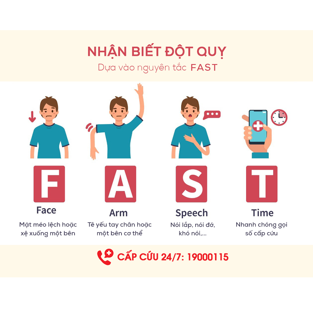 Nhận biết đột quỵ dựa vào nguyên tắc FAST