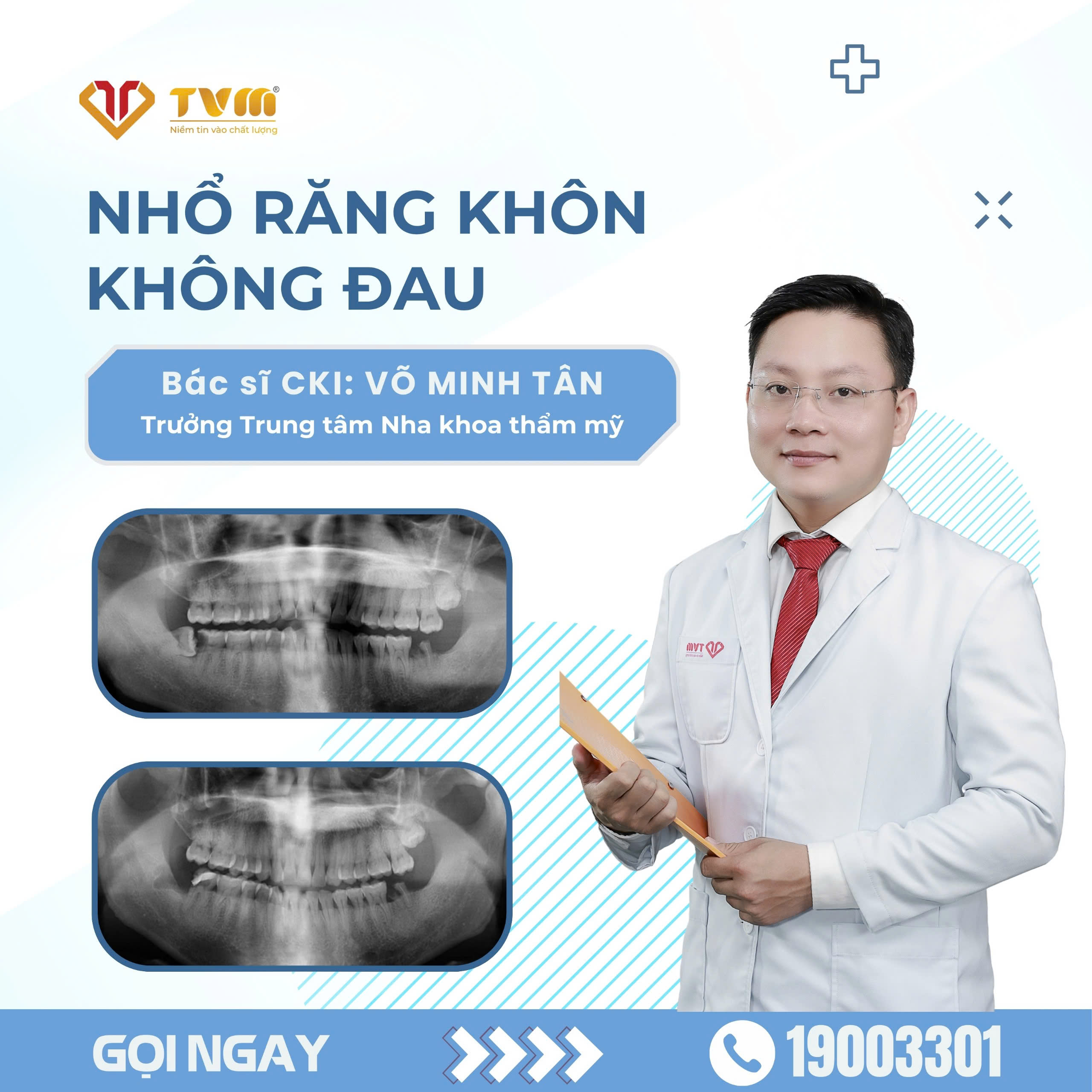 Nhổ răng khôn không đau