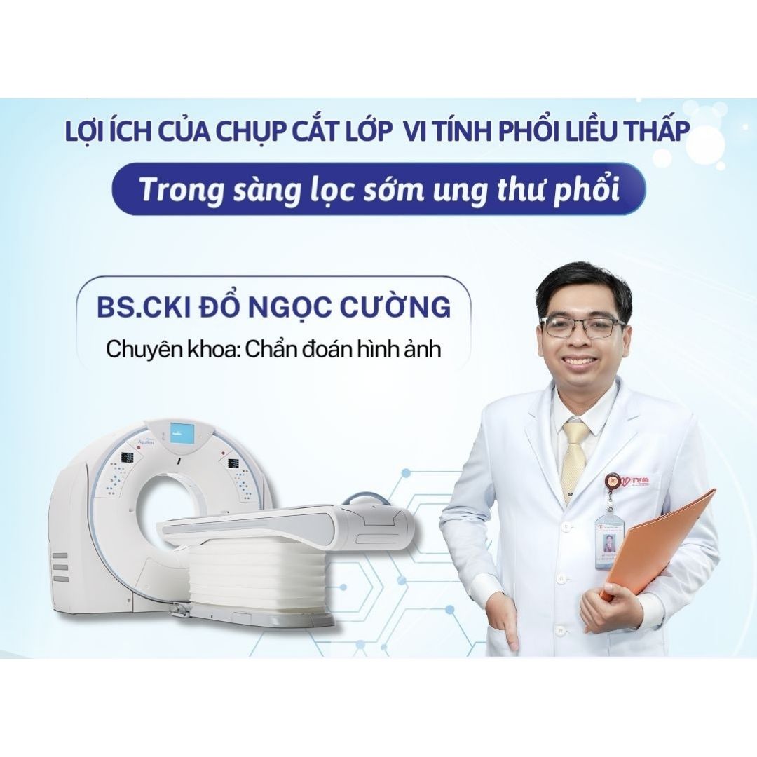 Lợi ích của cắt lớp vi tính phổi liều thấp trong sàng lọc sớm ung thư phổi