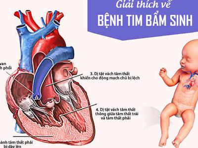 Dị tật tim bẩm sinh và những dấu hiệu cần biết