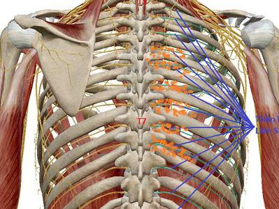 Chẩn đoán và điều trị chứng đau dây thần kinh liên sườn