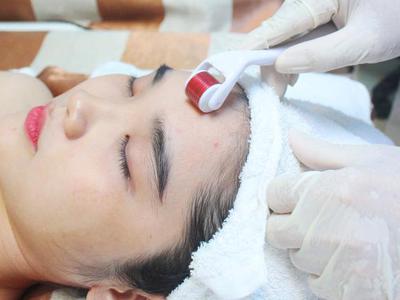 Ứng dụng lăn kim vi điểm trong điều trị da liễu