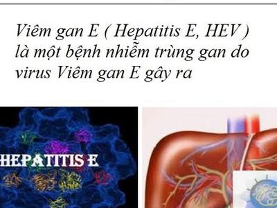 Bệnh viêm gan E là gì? Viêm gan E có nguy hiểm hay không?
