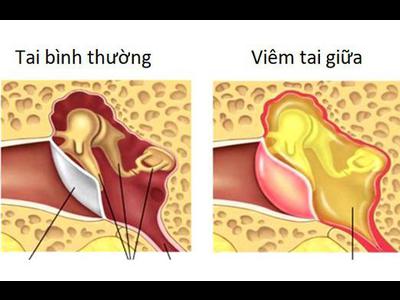 Top 7 bệnh lý tai mũi họng thường gặp nhất hiện nay