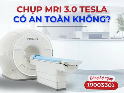 Chụp MRI 3.0 có an toàn không?