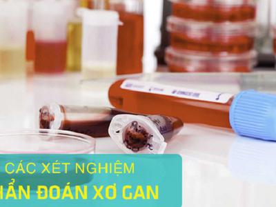 Làm thế nào để phát hiện sớm bệnh xơ gan?