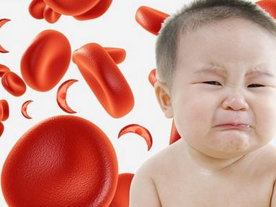 Thiếu máu thiếu sắt ở trẻ em